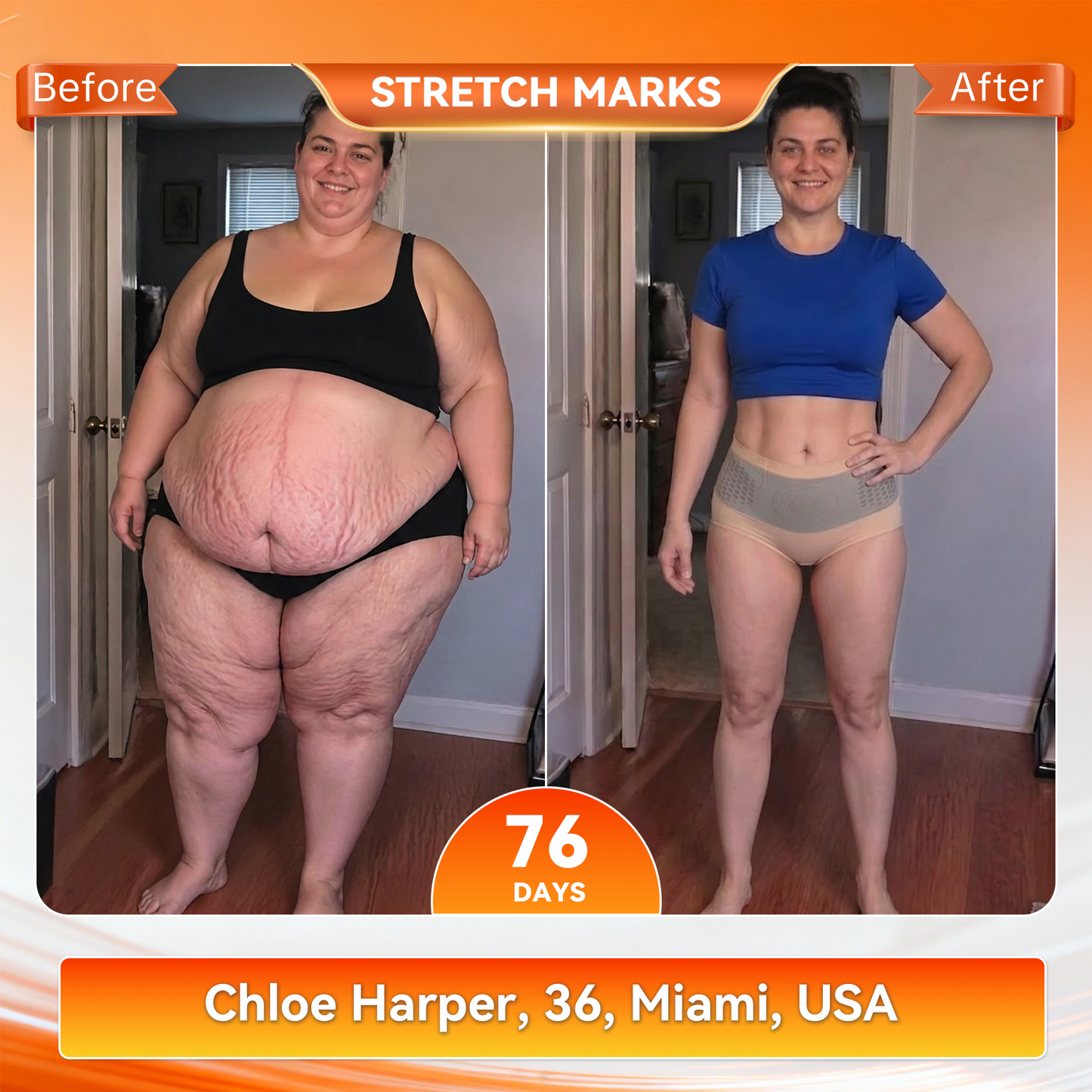 𝐎𝐟𝐟𝐢𝐜𝐢𝐚𝐥 𝐁𝐫𝐚𝐧𝐝 𝐒𝐭𝐨𝐫𝐞 🇺🇸| 𝐙𝐔𝐄𝐄𝐓® 𝟐𝟎𝟐𝟔 𝐌𝐨𝐫𝐢𝐧𝐠𝐚 x 𝐁𝐞𝐫𝐛𝐞𝐫𝐢𝐧𝐞 x 𝐍𝐀𝐃+ 𝟔-𝐈𝐧-𝟏 𝐌𝐢𝐜𝐫𝐨-𝐏𝐚𝐫𝐭𝐢𝐜𝐥𝐞 𝐒𝐜𝐮𝐥𝐩𝐭𝐢𝐧𝐠 & 𝐅𝐚𝐭-𝐁𝐮𝐫𝐧 𝐒𝐡𝐨𝐫𝐭𝐬 (Women + Men with Enhanced Male Vitality Blend)