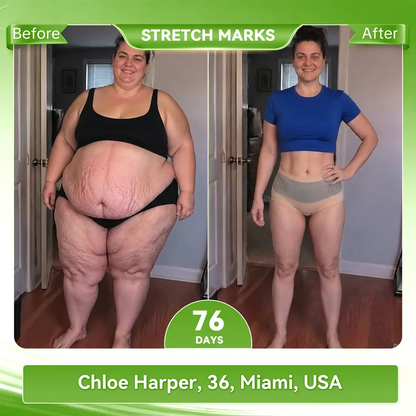𝐎𝐟𝐟𝐢𝐜𝐢𝐚𝐥 𝐁𝐫𝐚𝐧𝐝 𝐒𝐭𝐨𝐫𝐞 🇺🇸| 𝐀𝐊𝐘𝐆𝐎® 𝟐𝟎𝟐𝟔 𝐌𝐨𝐫𝐢𝐧𝐠𝐚 x 𝐁𝐞𝐫𝐛𝐞𝐫𝐢𝐧𝐞 x 𝐍𝐀𝐃+ 𝟔-𝐈𝐧-𝟏 𝐌𝐢𝐜𝐫𝐨-𝐏𝐚𝐫𝐭𝐢𝐜𝐥𝐞 𝐒𝐜𝐮𝐥𝐩𝐭𝐢𝐧𝐠 & 𝐅𝐚𝐭-𝐁𝐮𝐫𝐧 𝐒𝐡𝐨𝐫𝐭𝐬 (Women + Men with Enhanced Male Vitality Blend) (Copy)